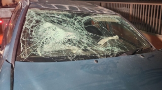 Bakıda qadını avtomobil vurub, ayağı amputasiya edilib 