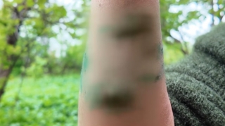 Ucarda çaqqal sakinlərə hücum etdi, xəsarət alanlar var - VİDEO