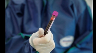 Выявлены 4 273 новых случая инфицирования коронавирусом, скончался 41 человек - ФОТО  - ФОТО