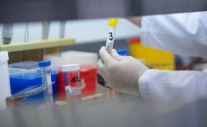 Azərbaycanda daha 15 nəfərdə koronavirus aşkarlandı