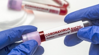 Koronavirus testlərinin maya dəyəri açıqlanıb