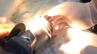 Lənkəranda azyaşlının əli ət maşınında qaldı