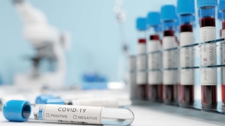 Koronavirusa qarşı immunitet 1 ay sonra təsirini itirir