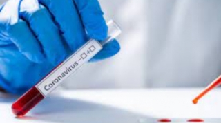 Azərbaycanda son sutkada 144 nəfər koronavirusa yoluxub, 8 nəfər ölüb 