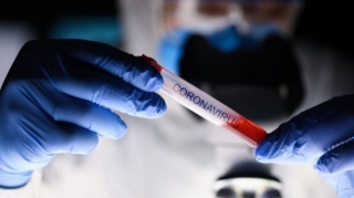 Azərbaycanda daha beş nəfər koronavirusdan öldü: 105 yeni yoluxma   - FOTO