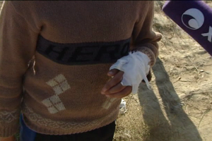 Bakıda DƏHŞƏT: Sahibsiz itlər azyaşlılara hücum çəkdi - VİDEO