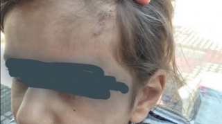 Atası tərəfindən şiddətə məruz qalan uşaqla bağlı məsələ DİN-in nəzarətindədir 