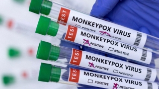 Ukraynada meymunçiçəyi virusuna ilk yoluxma qeydə alınıb