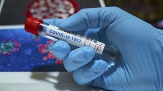 Azərbaycanda daha 601 nəfər COVID-19-a yoluxub, ölən olmayıb 