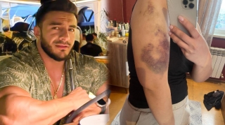 Eks-sevgilisindən Hidayətə ittihamlar - “550 min pulumu ələ keçirib, məni dəfələrlə döyüb” - FOTO