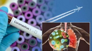 Azərbaycanda son sutkada 190 nəfər koronavirusa yoluxub 