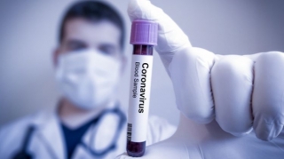 Azərbaycanda indiyədək 885 279 koronavirus testi aparılıb