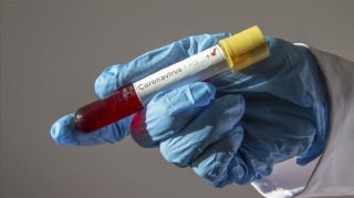Dünyada hazırlanmaqda olan koronavirus vaksinlərinin sayı açıqlanıb