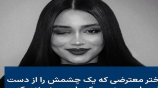 Molla rejimi gənc qızın gözünü çıxardı 