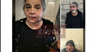 Şamaxıda evə girən oğru yaşlı ər-arvadı amansızcasına döydü - FOTO