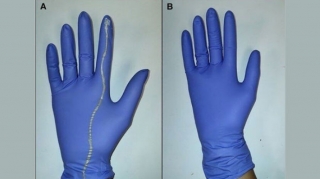 Создана "умная" перчатка, помогающая предотвратить осложнения при родах