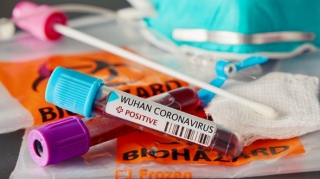 Azərbaycanda son sutkada 121 nəfər koronavirusa yoluxub, 1 nəfər ölüb 