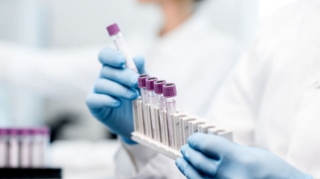 Bu günə olan yoluxma sayı AÇIQLANDI 