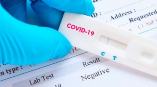 Son günlər koronavirusa yoluxmanın artmasının SƏBƏLƏRİ 