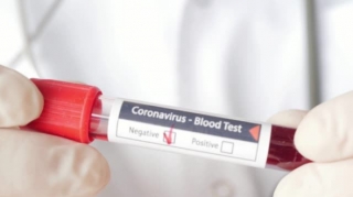 Dünyada koronavirusa yoluxanların sayı 9,6 milyonu keçdi