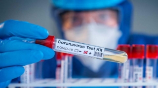 Azərbaycanda koronavirusla bağlı testlərin sayı 380 mini ötdü