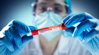 Ekspert koronavirusun müəyyənləşdirilməsi üçün testlərin müsbət və mənfi tərəflərini açıqladı