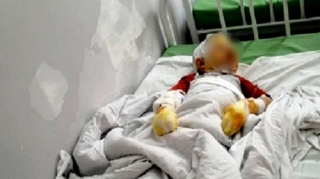 Ata 4 yaşlı oğlunu gölün qırağında YANDIRDI 