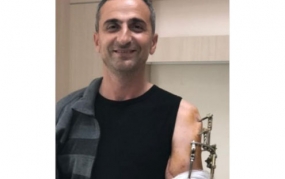 “Əyilib sağ əlimlə yerdən qolumu götürdüm  və uzaqlaşdım”