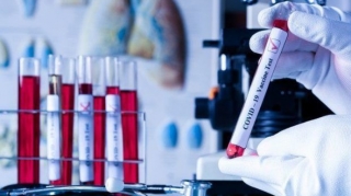 Azərbaycanda koronavirusa yeni yoluxanların sayı açıqlandı