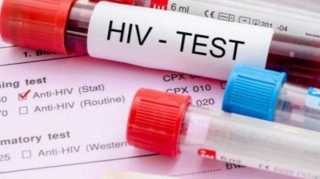 Azərbaycanda İİV-ə yoluxanların sayı açıqlandı 