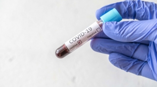 Daha 2 şagird və 7 məktəb işçisi koronavirusa yoluxub