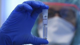 Azərbaycanda son sutkada 104 nəfər COVID-19-a yoluxub, 39 nəfər sağalıb