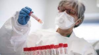 Azərbaycanda daha 337 nəfər COVID-19-a yoluxub – FOTO 