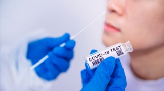 Azərbaycanda daha 337 nəfər COVID-19-a yoluxub, 6 nəfər vəfat edib 