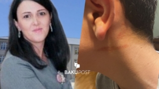 Məktəb direktoru şagirdi döydü - FOTO 