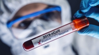 Bu günə olan yoluxma STATİSTİKASI 