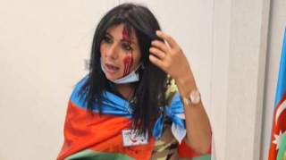 Ermənilər Hollandiyada azərbaycanlı jurnalistə xəsarət yetirdi – FOTO 