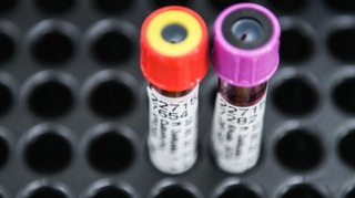 Bu şəxslərdə koronavirusa qarşı immunitet var