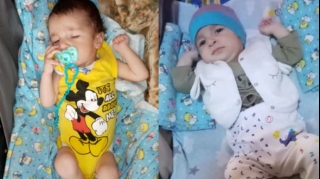 Körpə Əlinin yardımınıza ehtiyacı var  - FOTO