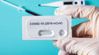 Azərbaycanda daha 431 nəfər koronavirusa yoluxdu, 3 nəfər vəfat edib - FOTO