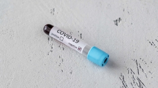 Azərbaycanda daha 68 nəfər COVID-19-a yoluxub  - FOTO