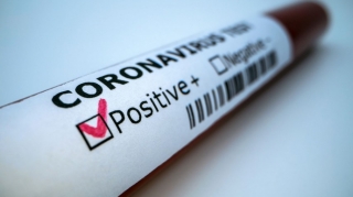 Azərbaycanda daha 1 156 nəfər koronavirusa yoluxub, 14 nəfər ölüb 