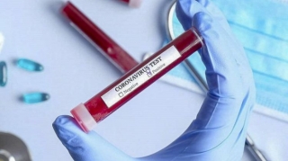 Azərbaycanda indiyədək 2 826 454 koronavirus testi aparılıb