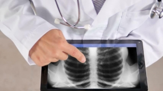 Qəbələdə ağır qəza, qadının qabırğaları sındı 