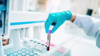 ÜST: Hazırda koronavirusun müalicəsi üçün dərman yoxdur 