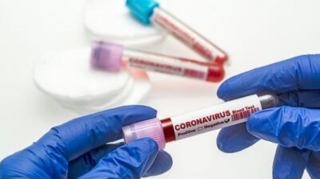 Koronavirusa yoluxanların son STATİSTİKASI 