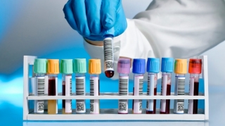 Son sutkada daha 19 nəfər koronavirusa yoluxub 