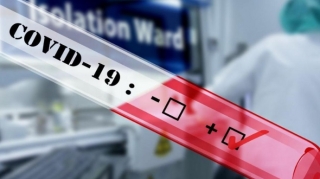 COVID-19-a son yoluxma statistikası açıqlandı 