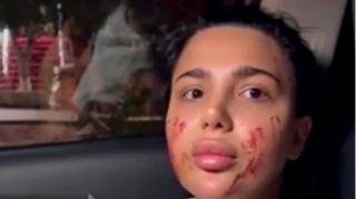 Qadına hücum etdiyi deyilən sabiq  məmur nəvəsi saxlanıldı 