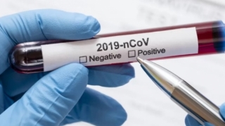 Qırğızıstanda koronavirusa yoluxanların sayı 1520 nəfərə çatıb